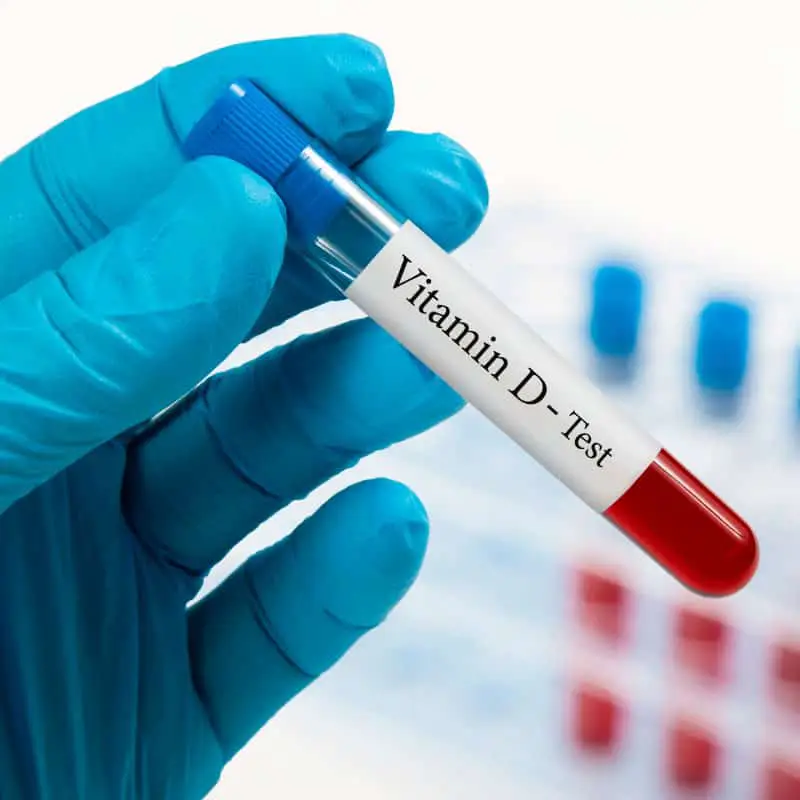 Easy & Convenient Vitamin Profile Tests at Home Life Aid